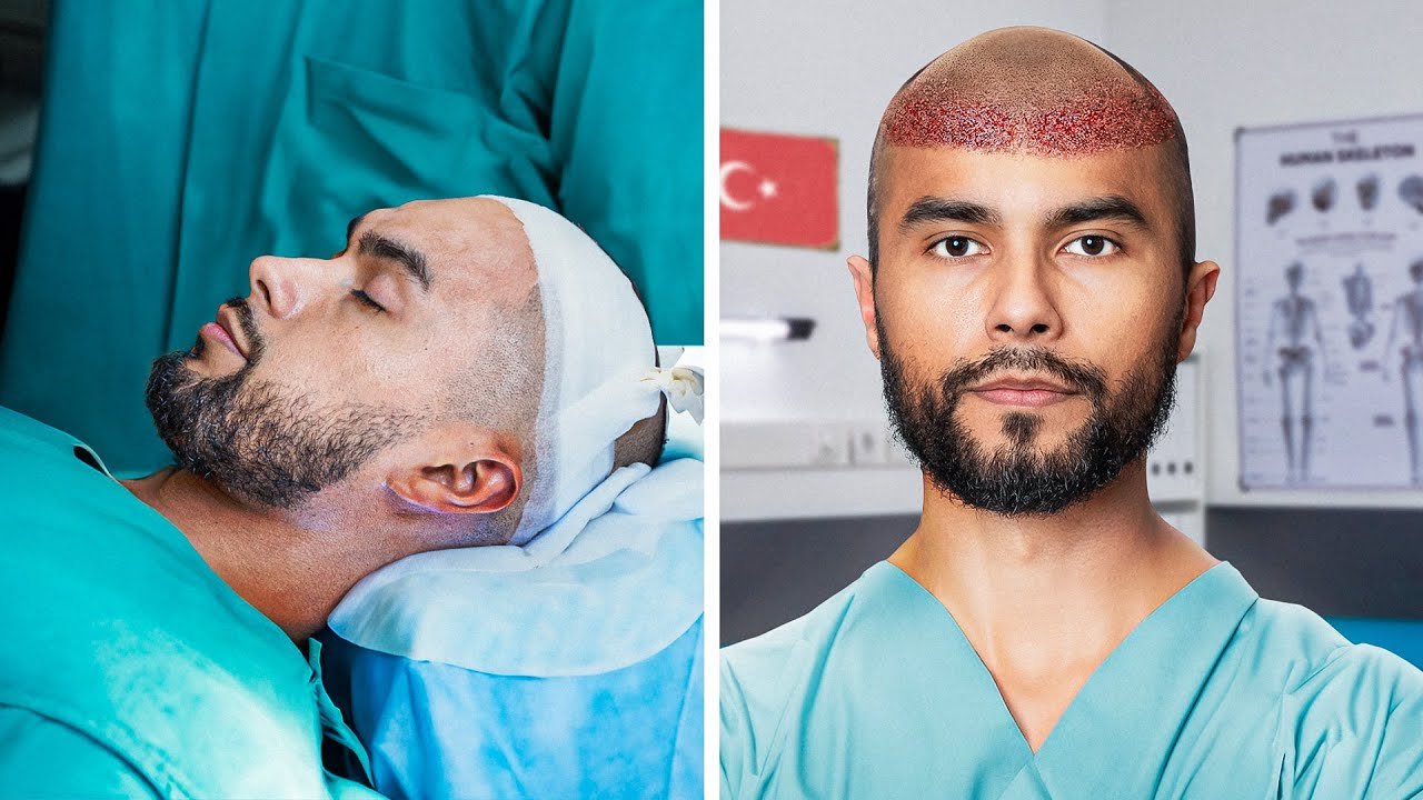 hair transplant cost in India