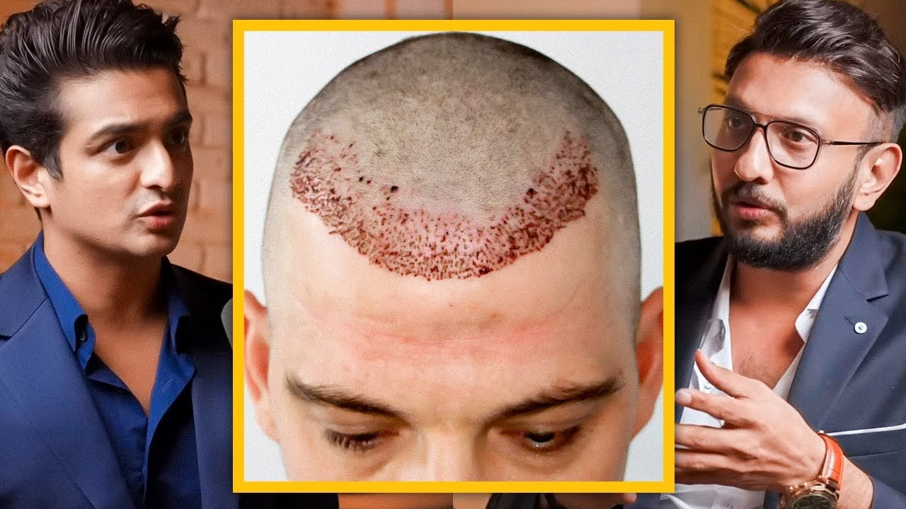 hair transplant cost in India